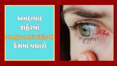 Gujarati Video : અમદાવાદ શહેરમાં 12 હજારથી વધુ કંજક્ટિવાઇટિસના કેસ નોંધાયા, જાણો કંજક્ટિવાઇટિસથી બચવા શું કરવુ