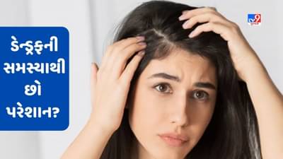 Dandruff Problem: ચોમાસામાં છો ડેન્ડ્રફની સમસ્યાથી પરેશાન? વાળનું ધ્યાન રાખવા આ ટિપ્સનો કરો ઉપયોગ