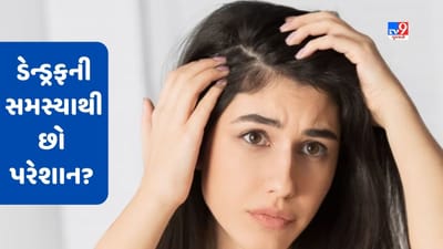 Dandruff Problem: ચોમાસામાં છો ડેન્ડ્રફની સમસ્યાથી પરેશાન? વાળનું ધ્યાન રાખવા આ ટિપ્સનો કરો ઉપયોગ