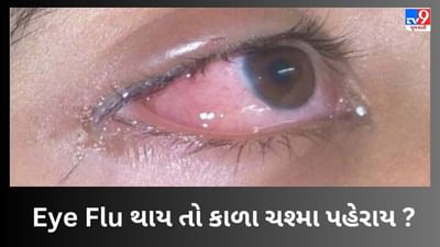 Eye Flu માં કાળા ચશ્મા પહેરવા કેટલા યોગ્ય ? જાણો શું કહે છે નિષ્ણાત