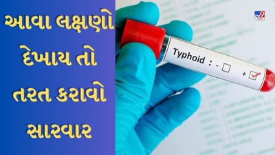 Typhoid : ભૂખ ન લાગવી અને તાવ આવવો હોઈ શકે છે ટાઈફોઈડનું લક્ષણ, કરાવો જલદી સારવાર