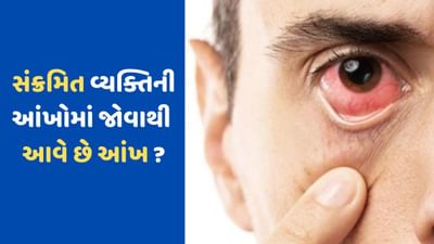 Eye Flu: શું ખરેખર સંક્રમિત વ્યક્તિની આંખમાં જોવાથી ફેલાય છે 'આઈ ફલૂ' ? જાણો શું કહે છે નિષ્ણાત અને શું કાળજી લેવી