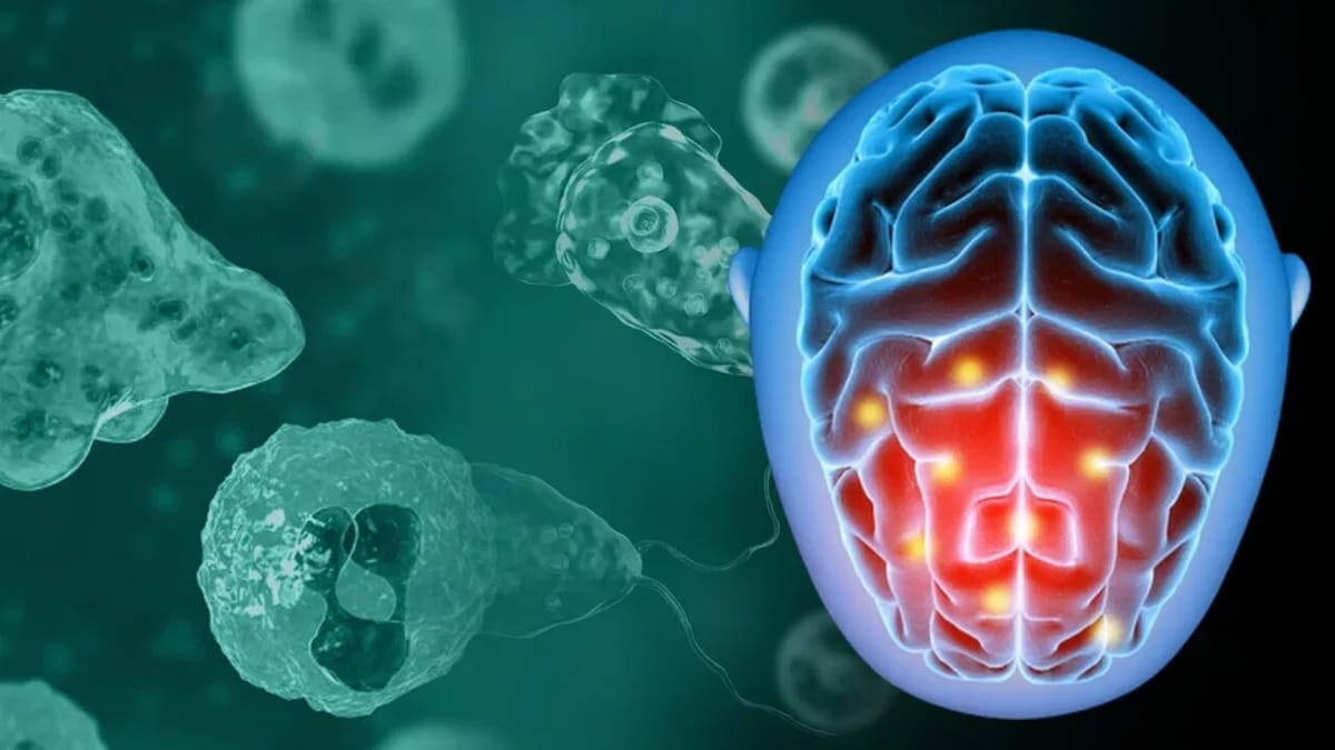 Brain Eating Amoeba : ખતરનાક કિસ્સો, કેરળના એક બાળકનું મગજ અમીબા ખાઈ જતા થયુ મોત, જાણો પહેલો કિસ્સો કયારે આવ્યો હતો સામે Brain Eating Amoeba : ખતરનાક કિસ્સો, કેરળના એક બાળકનું મગજ અમીબા ખાઈ જતા થયુ મોત, જાણો પહેલો કિસ્સો કયારે આવ્યો હતો સામે