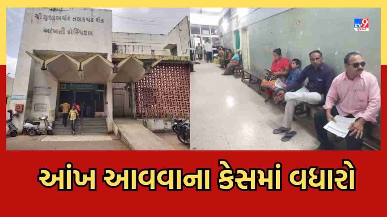 Rajkot: ચોમાસુ આવતા જ આંખ આવવાના કેસ વધ્યા, જાણો તેના લક્ષણો અને તકેદારી વિશે