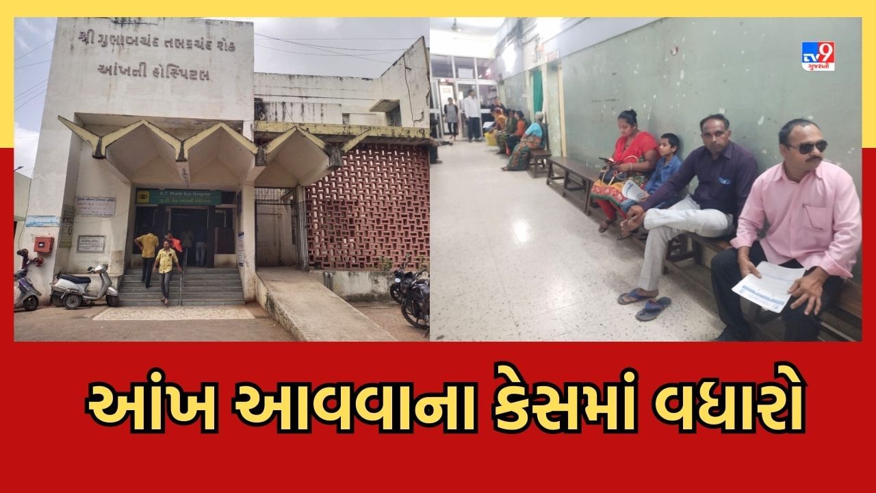 Rajkot: ચોમાસુ આવતા જ 'આંખ આવવાના' કેસ વધ્યા, જાણો તેના લક્ષણો અને તકેદારી વિશે