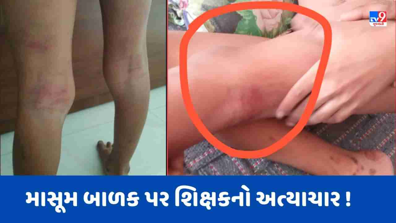 Breaking News: અમદાવાદની શક્તિ સ્કૂલમાં સિનિયર કેજીમાં ભણતા વિદ્યાર્થીને શિક્ષકે માર્યો માર, શિક્ષકને કરાયો સસ્પેન્ડ, જુઓ Video