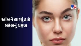 Dark Circles: ઓછી ઊંઘ, ફોનનો વધુ પડતો ઉપયોગ, આ આદતોને કારણે સ્કીન પર પડે છે ડાર્ક સર્કલ Dark Circles: ઓછી ઊંઘ, ફોનનો વધુ પડતો ઉપયોગ, આ આદતોને કારણે સ્કીન પર પડે છે ડાર્ક સર્કલ