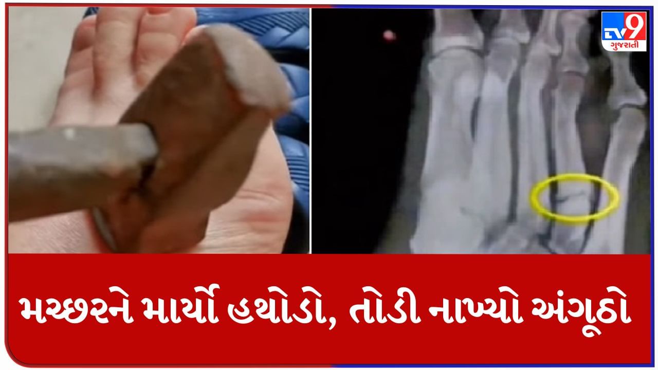 Funny Viral Video: વ્યક્તિએ મૂર્ખતાની પરાકાષ્ઠા ઓળંગી! પગ પર બેઠેલા મચ્છરને માર્યો હથોડો, તોડી નાખ્યો અંગૂઠો