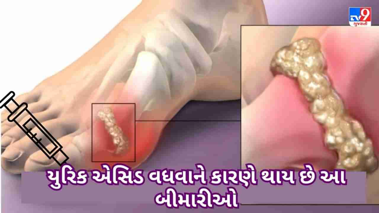 High Uric Acid: શરીરમાં યુરિક એસિડ વધવાને કારણે થાય છે આ બીમારીઓ, આ વસ્તુઓ સેવન કરવાનું ટાળો