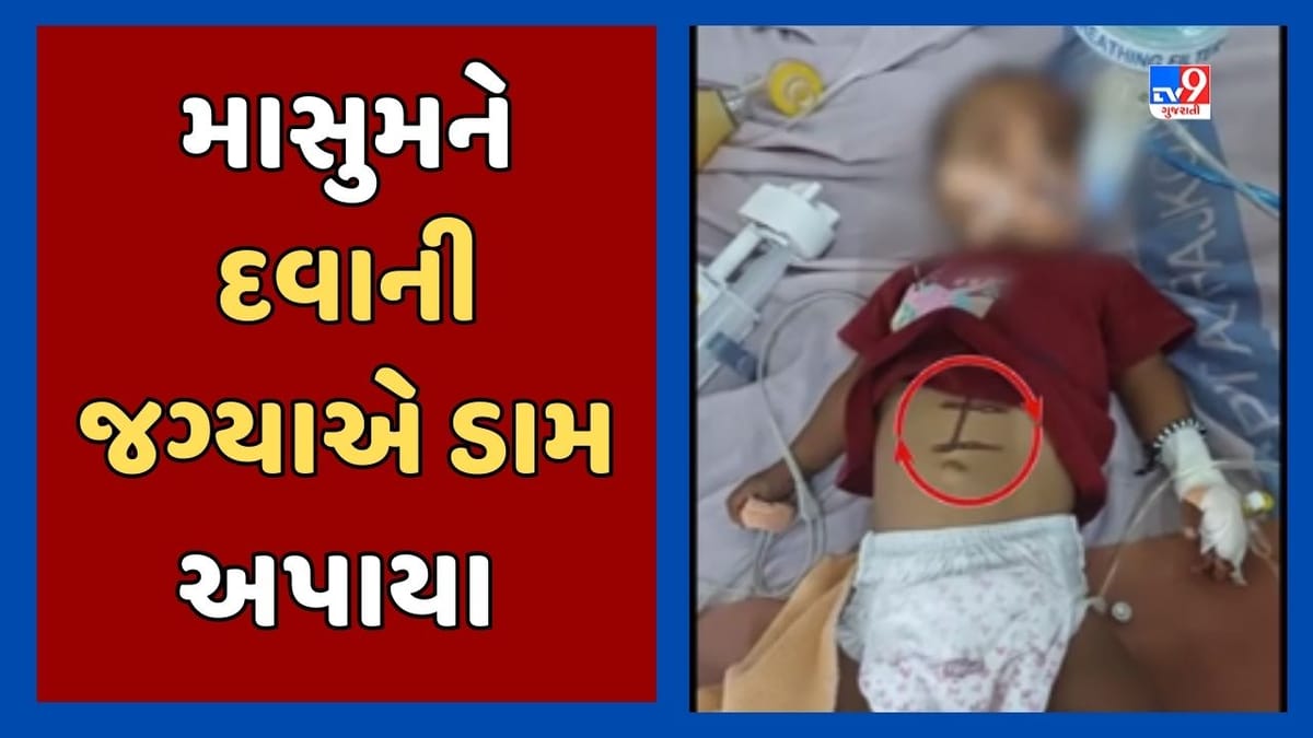 ફરી એકવાર આંધળી શ્રદ્ધા! 10 મહિનાની બાળકીને શરદી થતા માતા-પિતા તાંત્રિક પાસે લઇ ગયા, બાળકીને અપાયા ડામ, જૂઓ Video ફરી એકવાર આંધળી શ્રદ્ધા! 10 મહિનાની બાળકીને શરદી થતા માતા-પિતા તાંત્રિક પાસે લઇ ગયા, બાળકીને અપાયા ડામ, જૂઓ Video