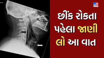 London News: છીંક રોકવાની કોશિશ કરતાં ફાટી ગયું ગળું, માંડ બચી શક્યો વ્યક્તિ, જાણો ડોક્ટરોએ શું આપી સલાહ