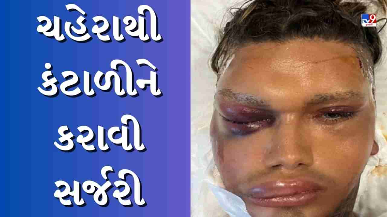 Viral Video : લો બોલો...આ વ્યક્તિને કંટાળો આવે એટલે કરાવે છે સર્જરી, હવે થઈ ગઈ આવી હાલત