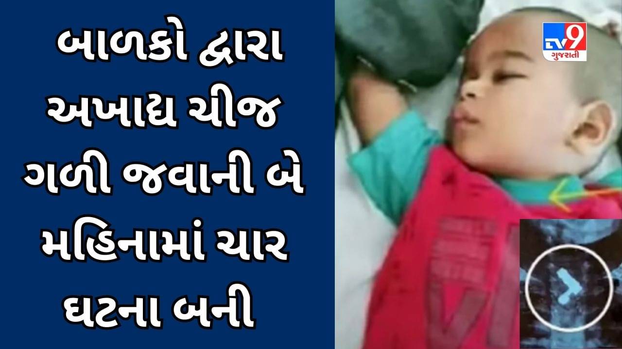 Surat Video : વાલીઓ માટે ચેતવણીરૂપ કિસ્સો, દોઢ વર્ષનું બાળક ઇલેક્ટ્રિક સોકેટ ગળી ગયું, તબીબોએ સર્જરી કરી જીવ બચાવી લીધો