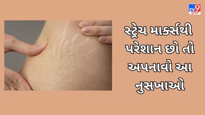 Stretch Marks: સ્ટ્રેચ માર્ક્સથી પરેશાન છો તો અપનાવો આ નુસખાઓ, થોડા દિવસોમાં જ નિશાન થઇ જશે ગાયબ