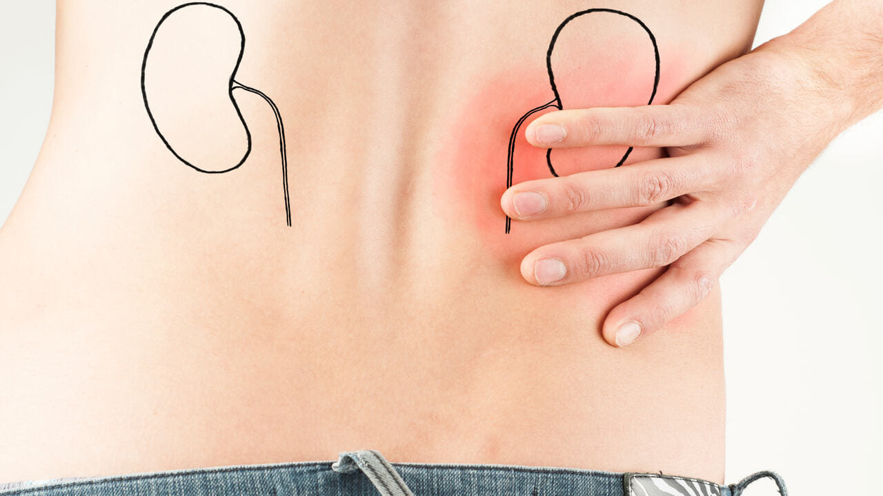 પ્રોટીન આપણા સ્વાસ્થ્ય માટે મહત્વપૂર્ણ છે, પરંતુ તેની વધુ પડતી માત્રા આપણી કિડનીને નુકસાન પહોંચાડે છે. વધુ પડતા પ્રોટીનયુક્ત ખોરાક ખાવાથી કિડની પર દબાણ આવી શકે છે. કઠોળ, દાળ અને અન્ય ઉચ્ચ પ્રોટીન વસ્તુઓ મર્યાદિત માત્રામાં જ ખાઓ.