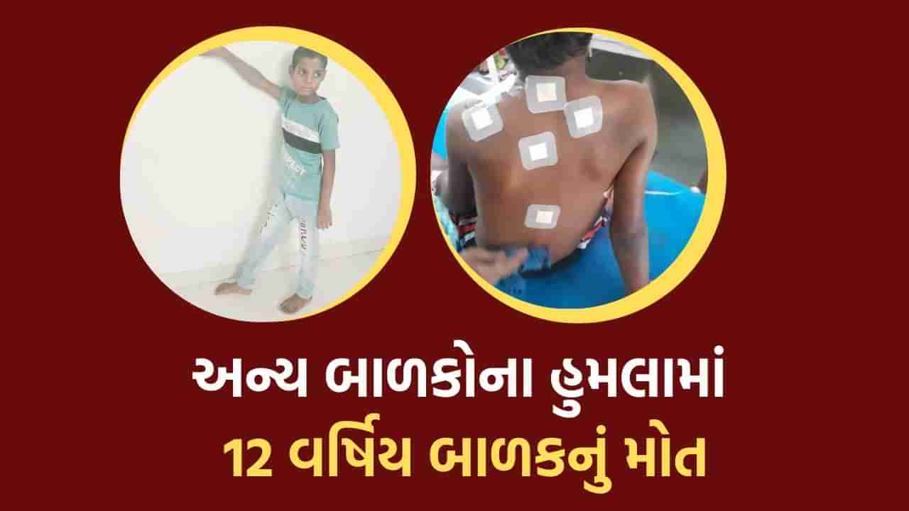 સુરત: 12 વર્ષના બાળક પર બે બાળકોએ કર્યો હુમલો, 1 મહિનો સારવાર લીધા બાદ બાળકનું મોત