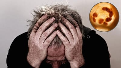 માણસના પેટમાંથી નીકળ્યા 'એલિયન' જેવા કીડા, તમે તો નથી કરતાને આ ભૂલ ?