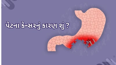 ભારતમાં પેટના કેન્સરના કેસ કેમ વધી રહ્યા છે? ચેતવણી સંકેત અને લક્ષણો