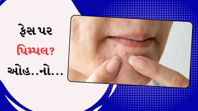 ફેસ પર થયેલા પિમ્પલ નખથી ફોડતા હોય તો ચેતજો! થઈ શકે છે....જુઓ વીડિયો