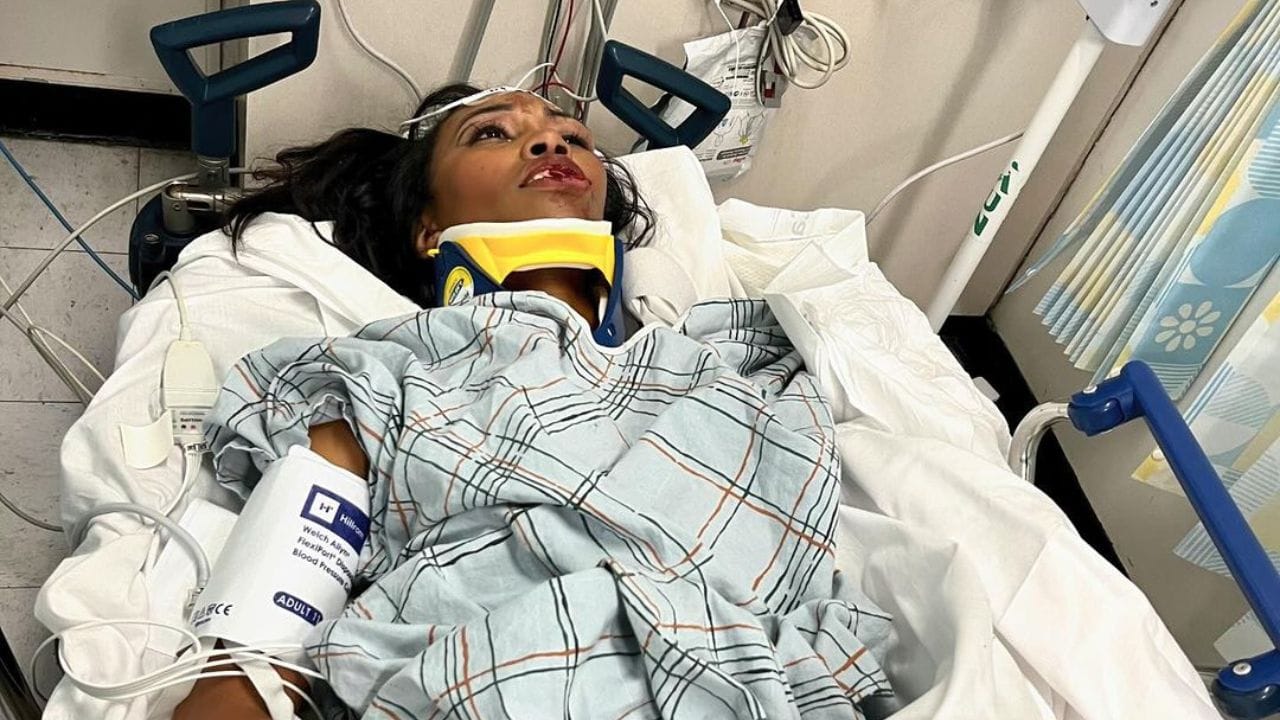 ફોટોમાં જોઈ શકાય છે કે કેરી બર્નાન્સનો ચહેરો ખરાબ રીતે ઘાયલ છે અને તેના દાંતમાંથી લોહી નીકળે છે. બીજા ફોટોમાં અભિનેત્રી બેડ પર સૂતી જોવા મળે છે. તેના આખા હાથ પર ઇજાઓ સ્પષ્ટપણે જોઈ શકાય છે.ફોટો શેર કરતાં અભિનેત્રીની માતા પેટ્રિશિયાએ લખ્યું, “તે હજુ પણ ખૂબ જ પીડામાં છે