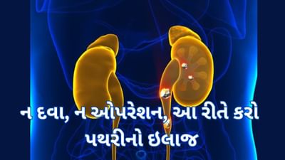 Kidney Stones Treatment : ન દવા, ન ઓપરેશન, કિડનીની પથરીને આ રીતે કરો દૂર, જાણી લો ઘરેલું ઉપાય