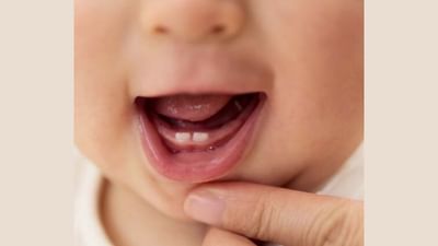 નાન બાળકોના દાંત 6 થી 7 મહિનાની ઉંમરે બહાર આવવા લાગે છે. બાળકો માટે આ સમય થોડો મુશ્કેલ છે. જ્યારે બાળકોને દાંત આવતા હોય છે, ત્યારે તેઓના પેઢામાં દુખાવો થતો હોય છે. જેના કારણે બાળકો વારંવાર ચિડાઈ જાય છે. રડ્યા કરે છે. આ સાથે બાળકોને દાંત આવતા હોય તે દરમિયાન લૂઝ મોશનની સમસ્યાનો પણ સામનો કરવો પડી શકે છે. આ સામાન્ય હોવા છતાં તે બાળકોમાં નબળાઈ લાવી શકે છે. તેથી આ સમયે શિશુની વધુ કાળજી લેવાની જરૂર છે. જો બાળકોને નવા દાંત ફુટતી વખતે કેટલીક બાબતોનું ધ્યાન રાખવામાં આવે તો કોઈ સમસ્યા થશે નહીં.
