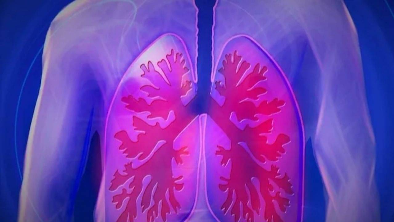 સુરત: કબૂતરના ચરકથી ફેફસામાં ઇન્ફેકશન થતાં વૃદ્ધનું મોત નીપજ્યું, જાણો બીમારી વિશે વીડિયો દ્વારા