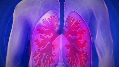 સુરત: કબૂતરના ચરકથી ફેફસામાં ઇન્ફેકશન થતાં વૃદ્ધનું મોત નીપજ્યું, જાણો બીમારી વિશે વીડિયો દ્વારા