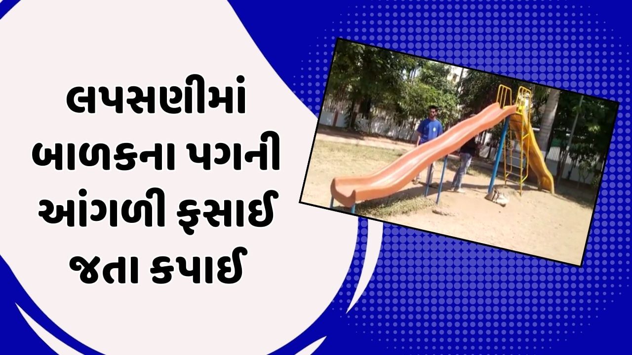 Vadodara Video: બગીચામાં લપસણીમાં બાળકના પગની આંગળી ફસાઈ જતા કપાઈ, પરિવારજનોએ મનપા પર કર્યા આક્ષેપ