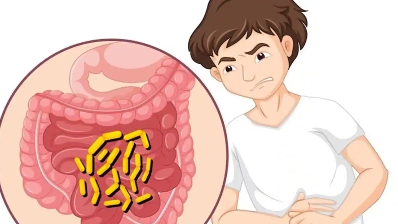 કૃમિનાશ માટે : તમને જણાવી દઈએ કે કેસૂડાના બીજમાં કૃમિ વિરોધી ગુણ જોવા મળે છે. આયુર્વેદમાં તેના બીજને પીસીને પેટના કીડાનો નાશ કરવા માટે તેનો ઉપયોગ કરવામાં આવ્યો છે.  કેસૂડાના બીજનું ચૂર્ણ નિયમિત સેવન કરવામાં આવે તો પેટના કીડા નાશ પામે છે. તમે તેને સવારે ખાલી પેટ એક ચમચી મધ સાથે ખાઈ શકો છો.(ફોટો ક્રેડિટ- સોશિયલ મીડિયા)