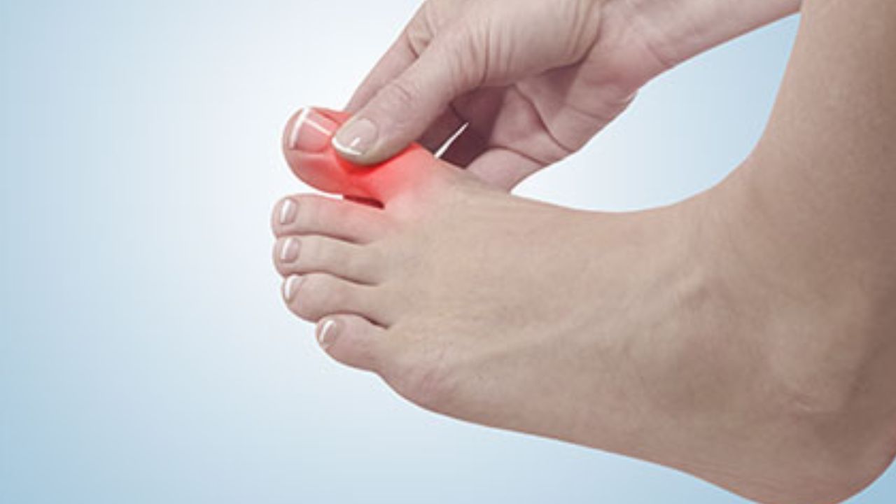 આ સિવાય તમારે સેલરી અને હળદર જેવી વસ્તુઓનું સેવન કરવું જોઈએ. આ સિવાય તમે ચિયા સીડ્સ ખાઈ શકો છો અને ગરમ પાણી પી શકો છો. આ વસ્તુઓ યુરિક એસિડને ઘટાડવામાં પણ મદદરૂપ થાય છે.