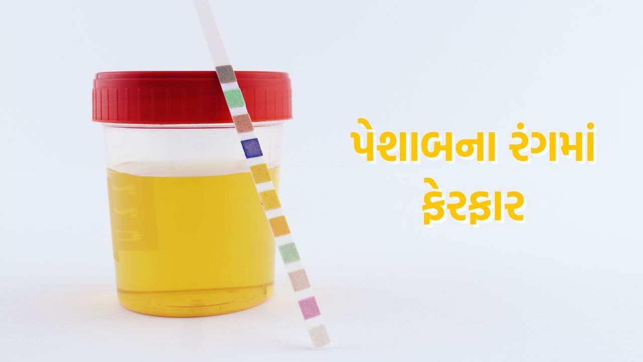 પેશાબના રંગમાં ફેરફાર પણ કિડનીના નુકસાનના લક્ષણો માનવામાં આવે છે. જો તમારા પેશાબનો રંગ પીળો, બ્રાઉન કે ધૂંધરો હોય તો તમારે તેને અવગણવું જોઈએ નહીં. તમારે ડૉક્ટરની વિઝિટ લઈ જરૂરી સારવાર કરાવવી જરૂરી બની જાય છે.
