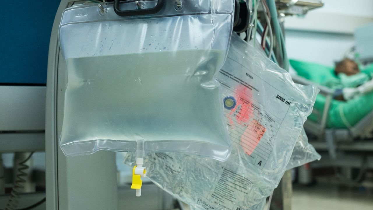  કિડની ફેલ થયા પહેલા કેટલાક લક્ષણો પેશાબમાં પણ જોઈ શકાય છે. એક્સપર્ટ ડૉ. વિકાસ જૈન દ્વારા જણાવ્યા અનુસાર અહીં આ સમગ્ર બાબતે માહિતી આપવામાં આવી છે