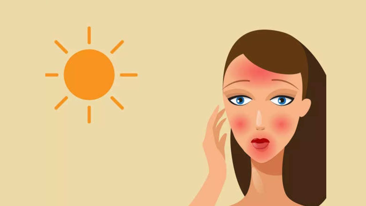 તેથી, દૈનિક દિનચર્યામાં ત્વચાને સૂર્યપ્રકાશના સીધા સંપર્કથી બચાવવા માટે, ફુલ સ્લીવ્સ કપડાંની સાથે સનસ્ક્રીનનો યોગ્ય રીતે ઉપયોગ કરવો મહત્વપૂર્ણ છે. ઘણી વખત લોકો સનસ્ક્રીન લગાવવાની સાચી રીત શું છે તે લોકો જાણતા નથી, જેના કારણે વ્યક્તિને સંપૂર્ણ લાભ મળતો નથી અને સનસ્ક્રીન લગાવવા છતાં ત્વચાને નુકસાન થાય છે. તો ચાલો જાણીએ સનસ્ક્રીન લગાવતા પહેલા કઈ કઈ બાબતો જાણી લેવી જોઈએ