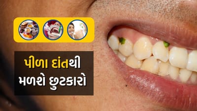 આજકાલ, દાંતને પોલિશ કરવાની ઘણી પદ્ધતિઓ ઓનલાઈન ઉપલબ્ધ છે. તેલ ખેંચવાથી માંડીને કોલસો ઘસવા અથવા હળદરથી બ્રશ કરવા સુધીના વિવિધ ઉપાયોથી દાંતને સરળતાથી ચમકાવવાનો દાવો કરવામાં આવે છે.