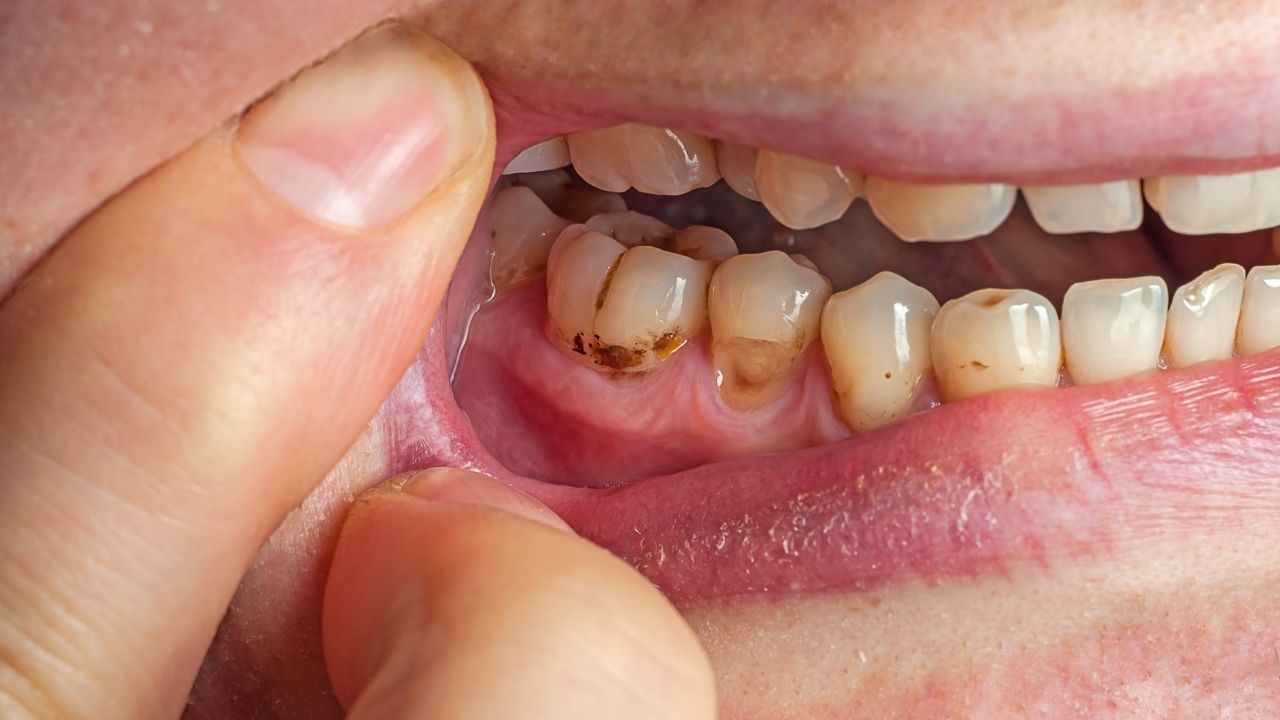 yellow teeth whiten american dental association best effective tips (7)