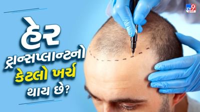 Hair Transplant : હેર ટ્રાન્સપ્લાન્ટનો કેટલો ખર્ચ થાય છે? ટ્રાન્સપ્લાન્ટ કરેલા વાળ માથા પર કેટલા વર્ષ રહે ? વાંચો સમગ્ર પ્રક્રિયા
