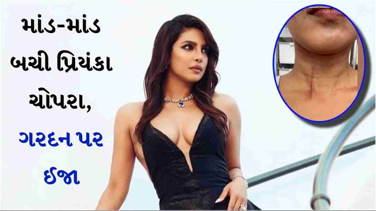 Priyanka Chopra Injured : માંડ માંડ બચી પ્રિયંકા ચોપરા, ધ બ્લફના સેટ પર અભિનેત્રીની ગરદન પર થઈ ઈજા