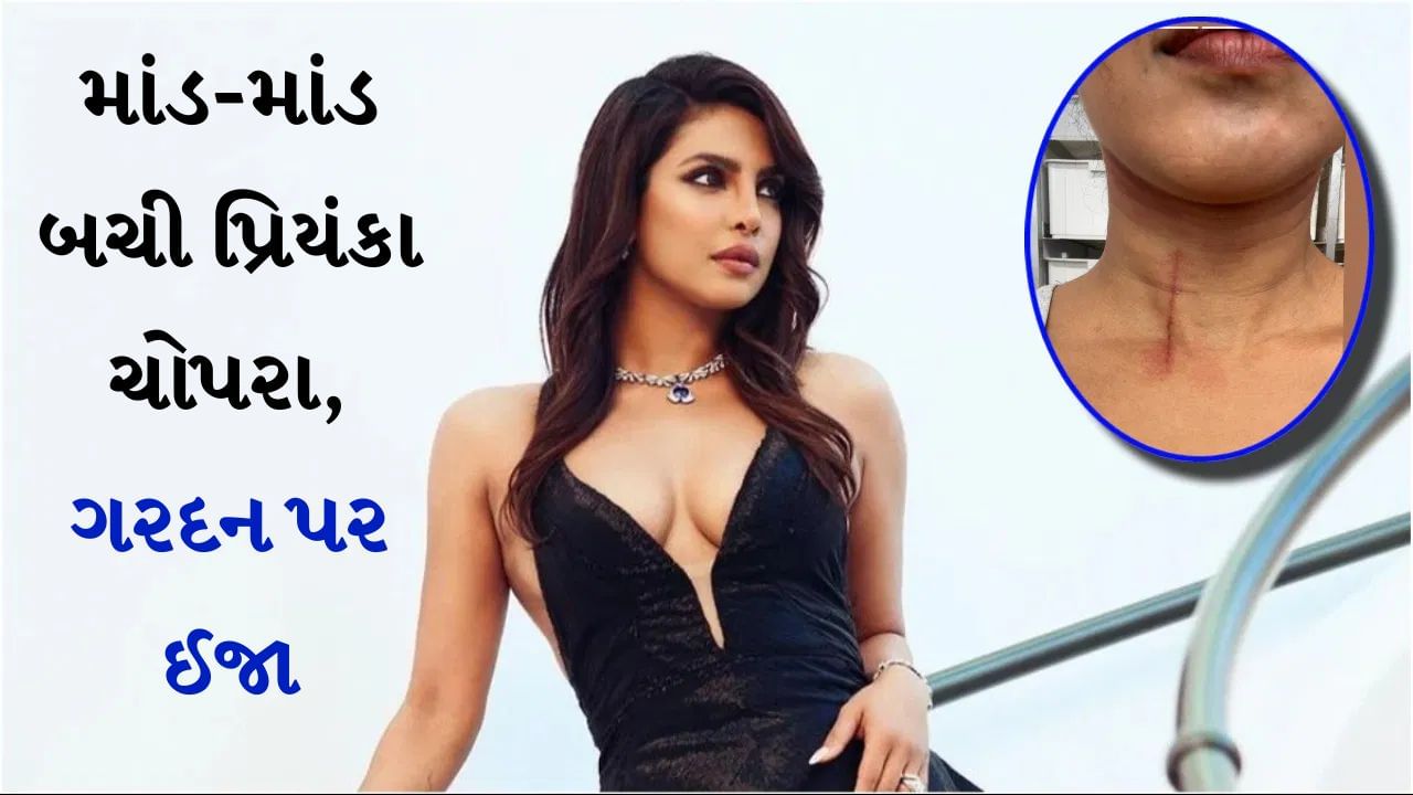 Priyanka Chopra Injured : માંડ માંડ બચી પ્રિયંકા ચોપરા, 'ધ બ્લફ'ના સેટ પર અભિનેત્રીની ગરદન પર થઈ ઈજા