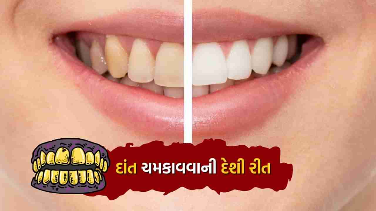 બીડી, સિગારેટ અને ગુટકા ખાવાથી દાંત થઈ ગયા છે પીળા ! ઘરે આ રીતે બનાવો ટૂથપેસ્ટ, દાંત દૂધની જેમ ચમકશે