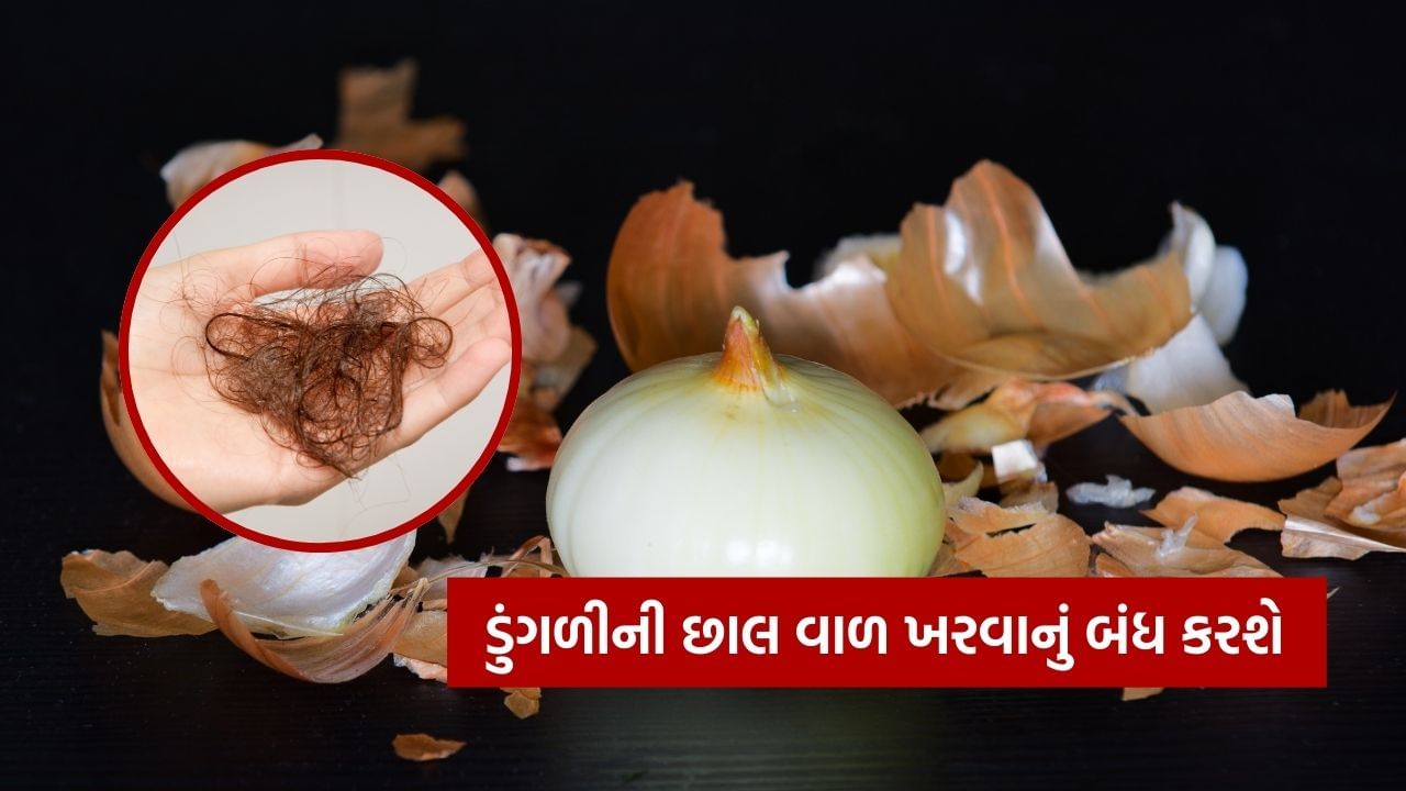 ડુંગળીની છાલને પાણીમાં ઉકાળો, તેને ઠંડુ કરો અને પછી આ પાણીથી માથાની ચામડી પર થોડીવાર માલિશ કર્યા પછી, વાળ ધોઈ લો. તેનાથી ડેન્ડ્રફની સમસ્યા દૂર થાય છે, આ સિવાય ડુંગળીની છાલના પાણીમાં એલોવેરા મિક્સ કરીને લગાવો. તે ડેન્ડ્રફથી છુટકારો મેળવવા ઉપરાંત વાળ ખરતા પણ ઘટાડે છે. તમે ડુંગળીની છાલને મિક્સરમાં પીસીને બારીક પાવડર પણ બનાવી શકો છો અને તેને એલોવેરા સાથે મિક્સ કરીને પણ લગાવી શકો છો.