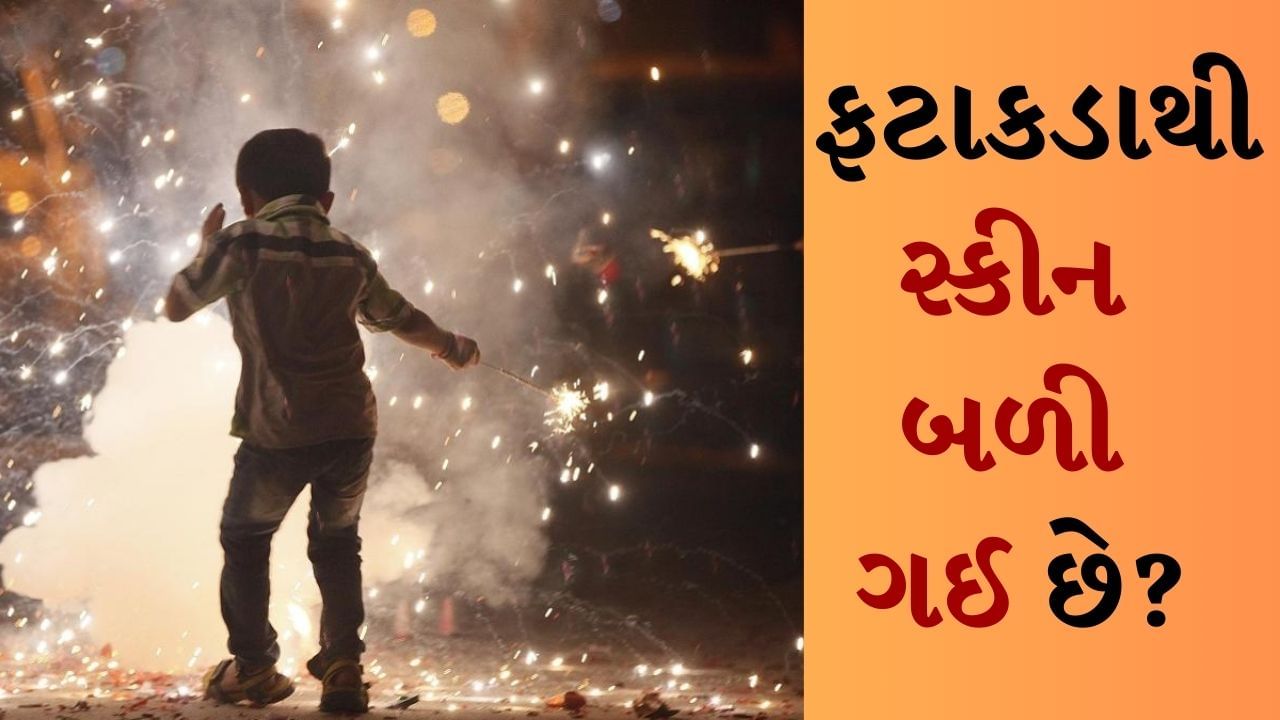 Burning from firecrackers : દર વર્ષે રોશનીના તહેવાર દિવાળી પર ભારે ઉત્તેજના હોય છે. લોકો તેમના ઘરને ફૂલો અને રોશનીથી શણગારે છે અને લક્ષ્મી-ગણેશની પૂજા કર્યા પછી, તેઓ આખા ઘરને દીવાઓથી પ્રગટાવે છે. આ ઉપરાંત આ દિવસે પુષ્કળ ફટાકડા પણ ફોડવામાં આવે છે. દિવાળી દરમિયાન ફટાકડા ફોડવાને કારણે ઘણી ઘટનાઓ જોવા મળે છે અને ફટાકડાને કારણે ત્વચા બળી જવાની ઘટનાઓ દિવાળી પર ખૂબ જ સામાન્ય છે. 
