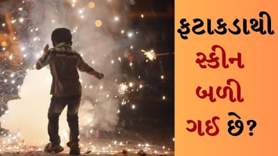 Burning from firecrackers : દર વર્ષે રોશનીના તહેવાર દિવાળી પર ભારે ઉત્તેજના હોય છે. લોકો તેમના ઘરને ફૂલો અને રોશનીથી શણગારે છે અને લક્ષ્મી-ગણેશની પૂજા કર્યા પછી, તેઓ આખા ઘરને દીવાઓથી પ્રગટાવે છે. આ ઉપરાંત આ દિવસે પુષ્કળ ફટાકડા પણ ફોડવામાં આવે છે. દિવાળી દરમિયાન ફટાકડા ફોડવાને કારણે ઘણી ઘટનાઓ જોવા મળે છે અને ફટાકડાને કારણે ત્વચા બળી જવાની ઘટનાઓ દિવાળી પર ખૂબ જ સામાન્ય છે.