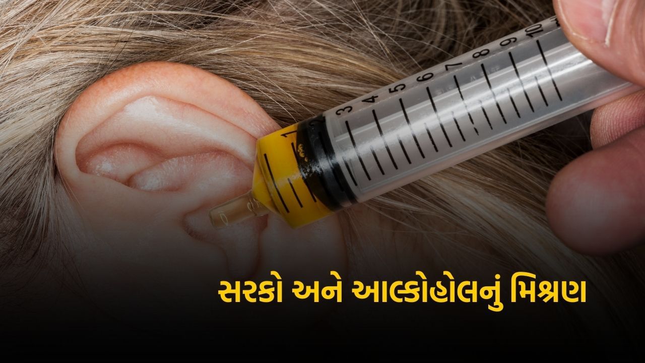 કાનના ચેપને રોકવા અને સાફ કરવા માટે સરકો અને આલ્કોહોલનું મિશ્રણ ઉપયોગી રેસીપી છે. સફેદ સરકો અને આલ્કોહોલ સમાન પ્રમાણમાં મિક્સ કરો. આ મિશ્રણના થોડા ટીપા કાનમાં નાખો અને થોડીવાર માથું નમેલું રાખો. આ મિશ્રણ કાનની અંદરની ગંદકીને ઢીલું કરે છે અને ચેપનું જોખમ પણ ઘટાડે છે.