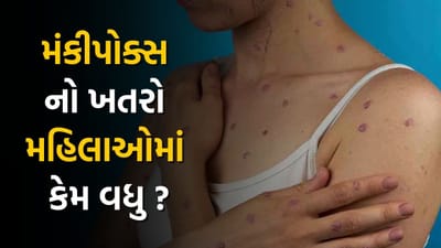 મંકીપોક્સનો ખતરો પુરુષો કરતાં સ્ત્રીઓમાં કેમ વધારે, જુઓ Video