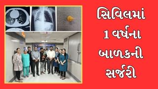 એક વર્ષનો બાળક મકાઇનો દાણો ખાઇ જતા ફેફસામાં ફસાયો, અમદાવાદ સિવિલમાં કરાઇ સર્જરી, માંડ બચ્યો જીવ, જુઓ Video