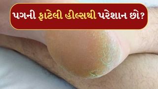 Cracked Heels : શું શિયાળામાં પગની હીલ્સ ફાટી જાય છે? આ 3 ઘરેલું ટિપ્સ ફોલો કરો