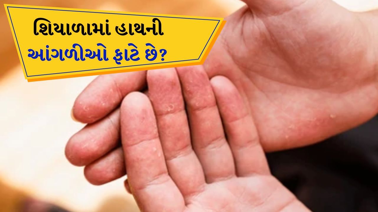 Cracked Fingertips : સુંદર આંગળીઓ તમારી સુંદરતામાં વધારો કરી શકે છે. હાથની સુંદરતા જાળવી રાખવા માટે આંગળીઓનું મુલાયમ હોવું જરૂરી છે. આવી સ્થિતિમાં, જો શિયાળામાં તમારી આંગળીઓ ખૂબ જ ફાટી જાય છે, તો આજે અમે તમને કેટલાક ઘરેલું ઉપાય જણાવવા જઈ રહ્યા છીએ. આ ઉપાયોથી, તમારી આંગળીઓ પહેલા કરતા વધુ સુંદર દેખાશે.
