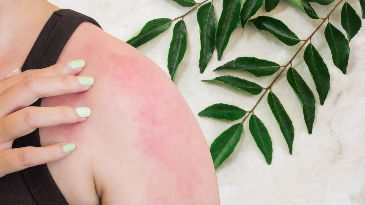 જે લોકોને લીલા પાંદડાવાળા શાકભાજી અથવા છોડથી એલર્જી હોય તેમણે મીઠા લીમડાના પાનનું સેવન ન કરવું જોઈએ.