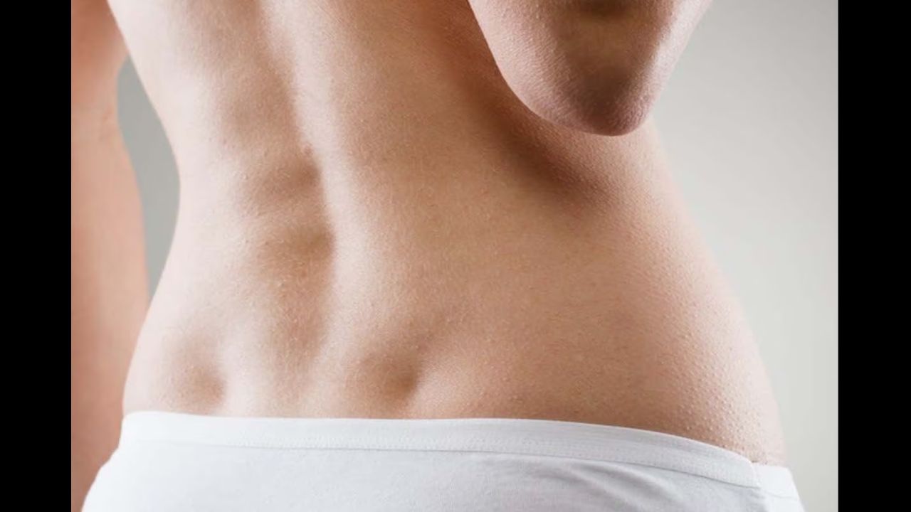 એવા ઘણા લોકો છે જેમની પીઠ પર આવા ડિમ્પલ હોય છે. આ ડિમ્પલને ડીમ્પલ્સ ઓફ વિનસ અથવા વિનસ હોલ કહેવામાં આવે છે. આનું કારણ એ છે કે રોમમાં શુક્રને સુંદરતાની દેવી માનવામાં આવે છે અને જે મહિલાઓને આ ડિમ્પલ હોય છે તે સુંદર અને ભાગ્યશાળી માનવામાં આવે છે.